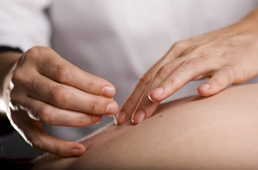 How Acupuncture Can Help Relieve Nerve Pain and Damage